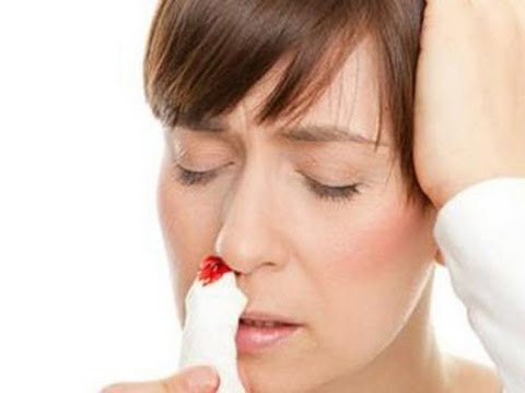 Tại sao cao huyết áp gây chảy máu mũi?