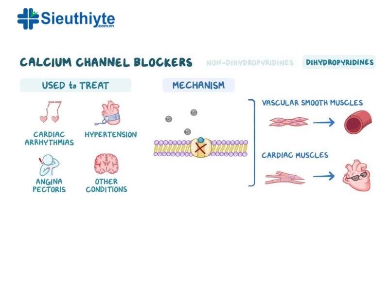 Thuốc chẹn kênh canxi thường được sử dụng cho bệnh nhân bị đau thắt ngực ổn định