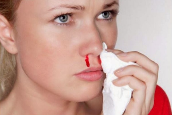 Huyết áp tăng đến mức nào thì có thể gây chảy máu mũi?
