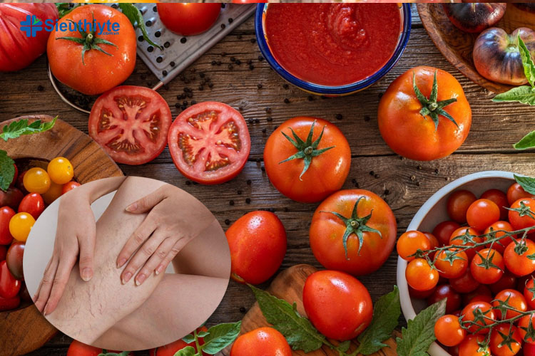 Tác dụng của cà chua trong chữa giãn tĩnh mạch 