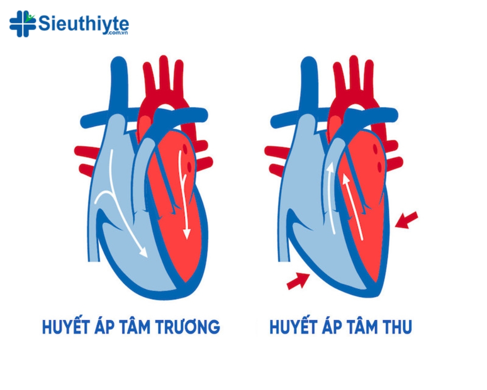 Hình ảnh minh họa về trái tim người ở hai trạng thái huyết áp tâm trương và huyết áp tâm thu.