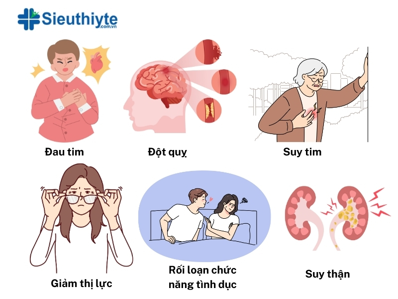 Bệnh cao huyết áp nếu không kiểm soát sẽ dẫn đến các biến chứng nguy hiểm