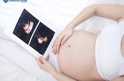 Mẹ bầu được chỉ định siêu âm tim từ tuần thứ 20 – 22 để kiểm tra dị tật thai nhi