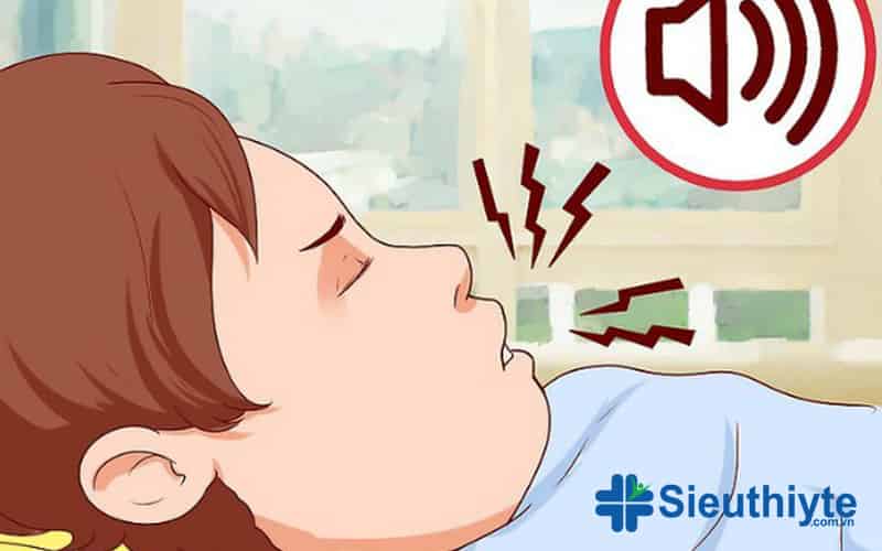 Cách chữa ngủ ngáy hiệu quả tại nhà