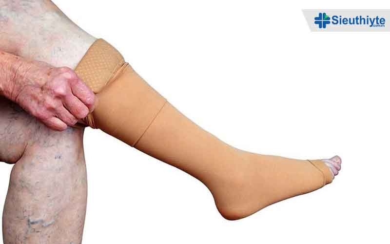 Vì sao vớ y khoa giãn tĩnh mạch chân được chuyên gia khuyên dùng