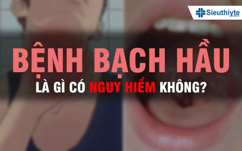 Bệnh bạch hầu là gì có nguy hiểm không?