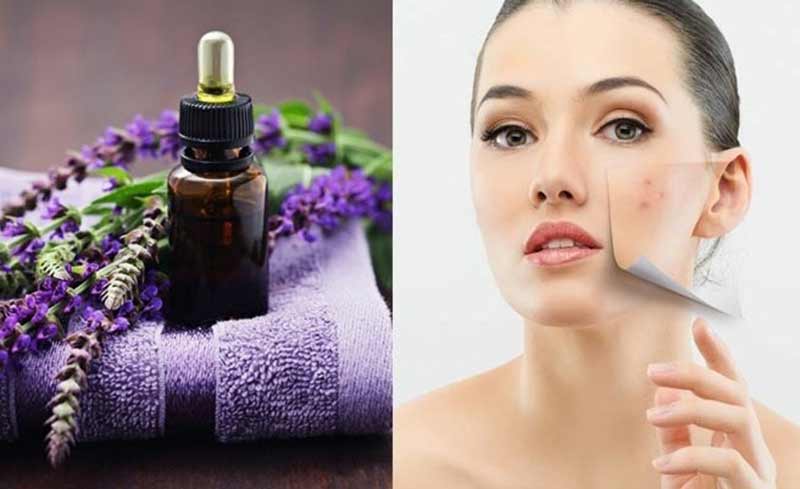 Tinh dầu trị mụn đang thịnh hành nhất hiện nay. (Ảnh: Internet). Tinh dầu trị mụn đang thịnh hành nhất hiện nay. (Ảnh: Internet).