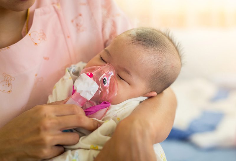 Thở áp lực dương liên tục (CPAP) dùng để hỗ trợ và điều trị trẻ bị suy hô hấp cấp