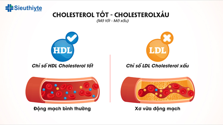 Cholesterol là chất béo trong máu được sản xuất tự nhiên gồm cholesterol “xấu” và cholesterol “tốt”