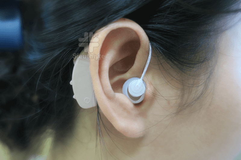 Máy trợ thính là thiết bị hỗ trợ âm thanh cho những người bị mất thính giác từ nhẹ đến nặng