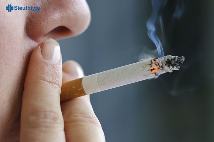 Chất nicotine trong thuốc lá làm co mạch máu và tăng huyết áp