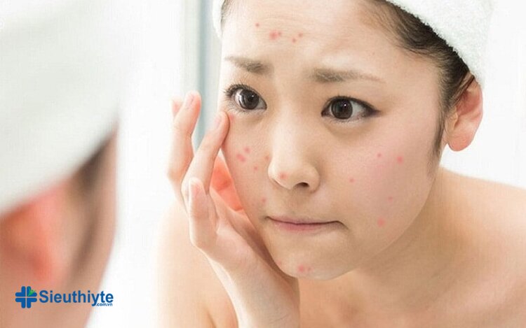 Có thể làn da của bạn nhạy cảm là do dị ứng với các sản phẩm bạn sử dụng