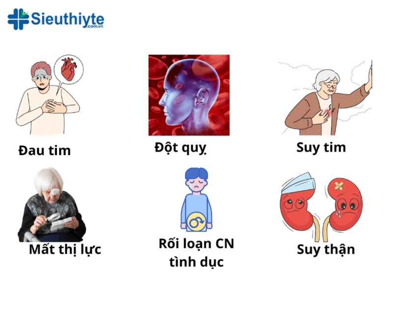 Hình ảnh minh họa các biến chứng nguy hiểm của cao huyết áp như đột quỵ, nhồi máu cơ tim, và suy thận.