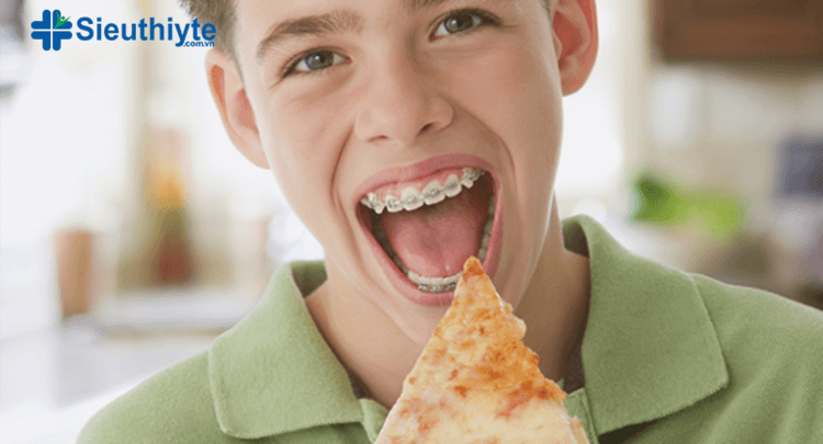 Bạn vẫn có thể ăn pizza khi niềng răng