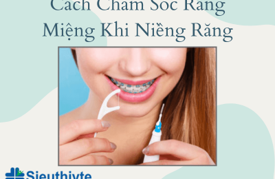 Cach-Cham-Soc-Rang-Mieng-Khi-Nieng-Rang