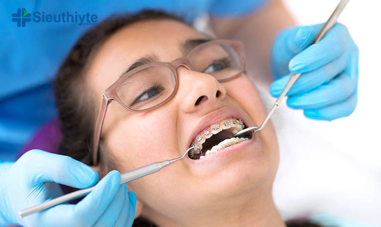 Trong thời gian niềng răng, bạn sẽ phải thường xuyên đến gặp bác sĩ chỉnh nha