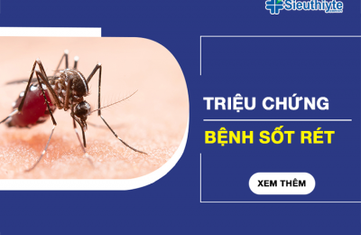 trieu chung benh sot ret avt3