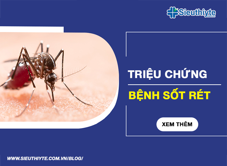 Triệu chứng bệnh sốt rét