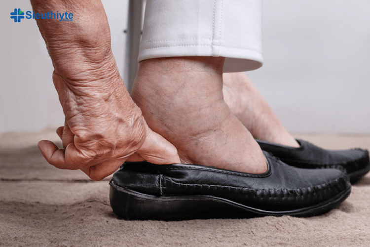 Biến chứng của tình trạng chân bị phù ở người già