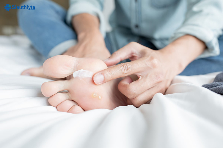 Bệnh nhân tiểu đường có thể dùng kem dưỡng ẩm để làm mềm da ở chân