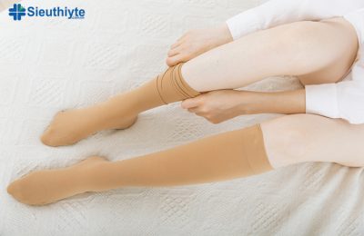 Bạn cần xác định khu vực bị ảnh hưởng nằm ở đâu trên chân để tìm vớ giãn tĩnh mạch có độ cao phù hợp