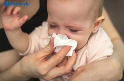 Trẻ sơ sinh có thể bị nghẹt mũi đi kèm với sổ mũi