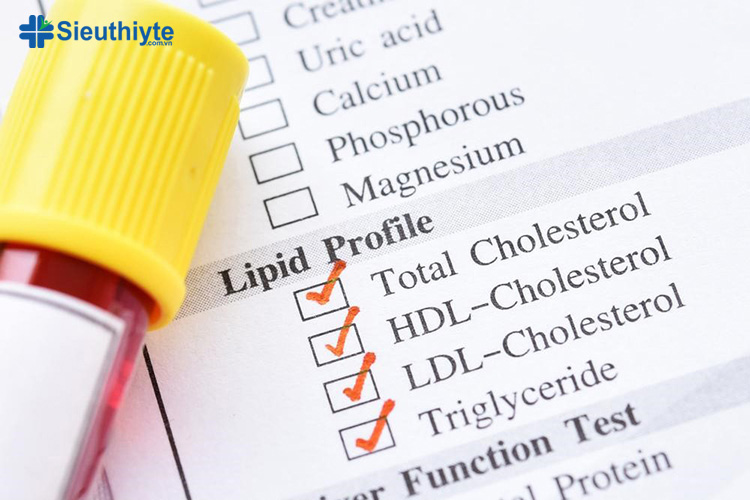 4 loại thành phần lipid máu thường được xét nghiệm khi theo dõi sức khỏe
