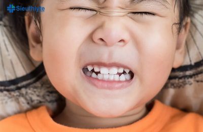 Trẻ nghiến răng thiếu chất gì?