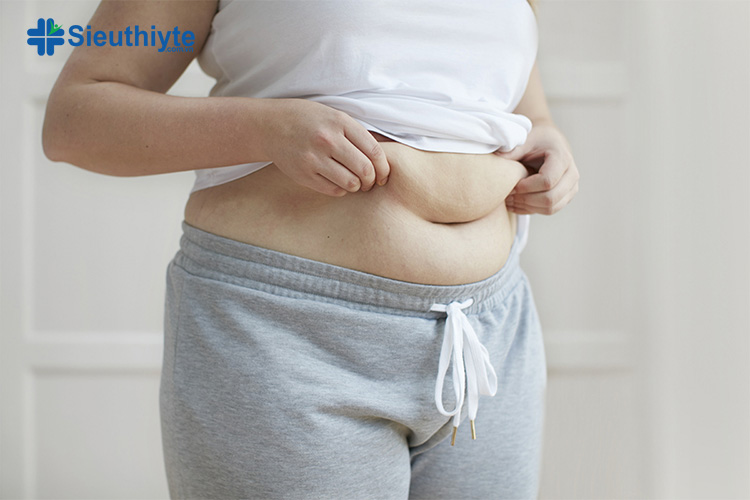 Mỡ bụng tích tụ thường do lối sống kém lành mạnh, không tập thể dục