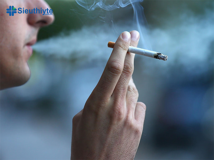 Hút thuốc gây ra khoảng 90% ca bệnh COPD