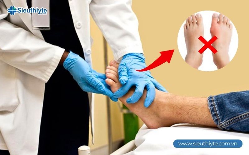 5 Trường hợp cần mổ hạt tophi