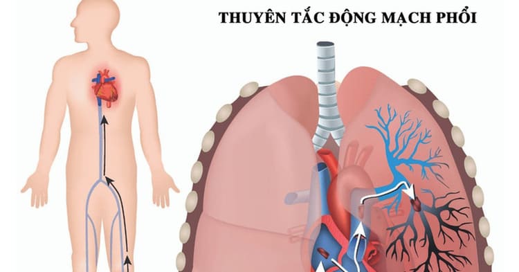 Khó thở là bệnh gì? Hô hấp là nguyên nhân gây khó thở