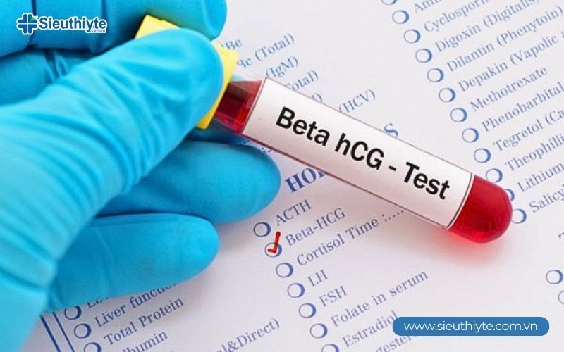Xét nghiệm beta-hCG giúp xác định bạn có mang thai hay không với độ chính xác cao nhất.