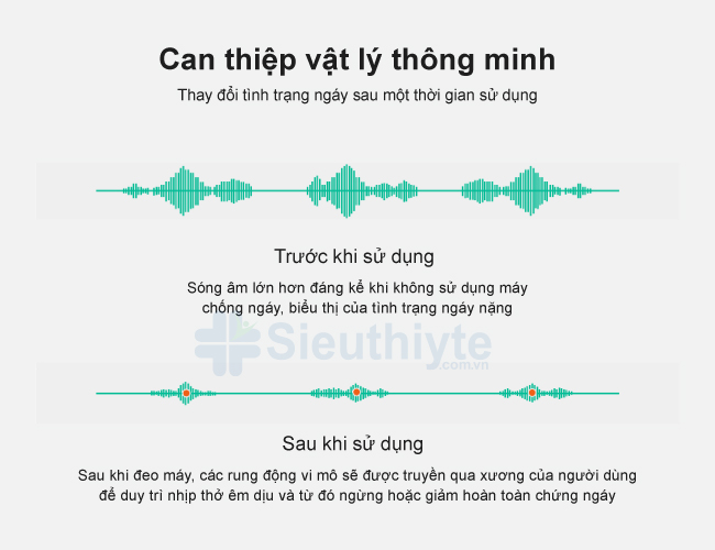 Sóng âm trước và sau khi sử dụng máy chống ngáy Snore Circle YA1323