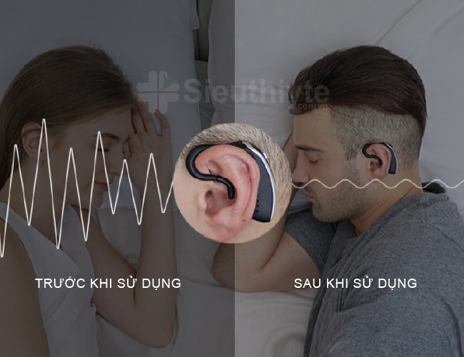 Mô tả tình trạng ngáy trước và sau khi sử dụng