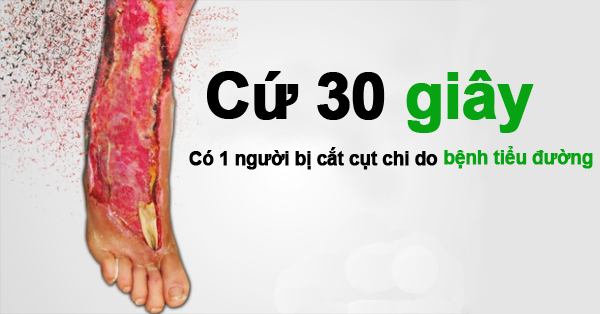 Bệnh Tiểu Đường - Những Con Số Đáng Báo Động